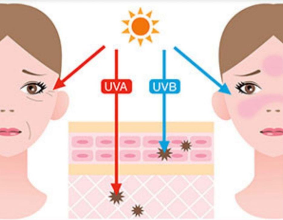 Tác hại của tia UV (UVA, UVB) lên da người